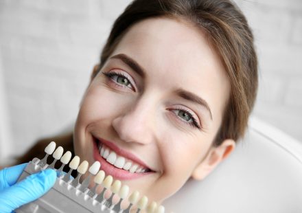 Dental Veneers in Australia