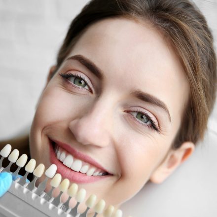 Dental Veneers in Australia