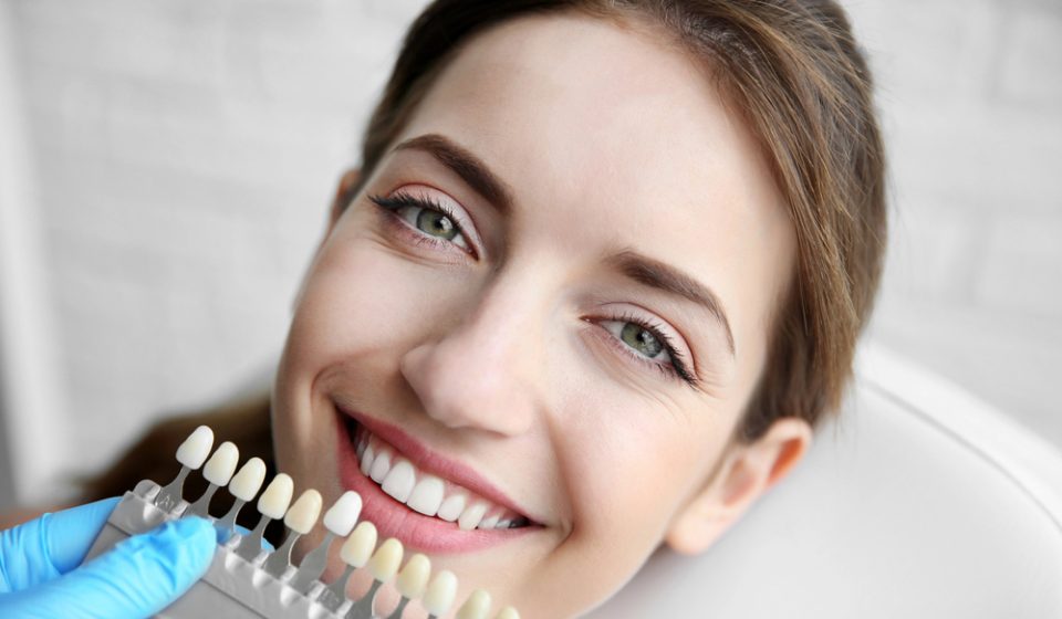 Dental Veneers in Australia